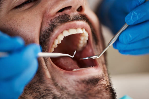 Best Pediatric Emergency Dentist in Raleigh, NC